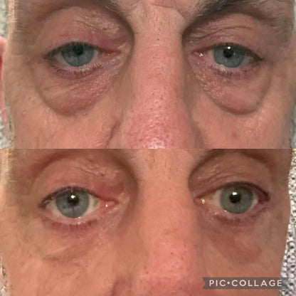 Age Reversist